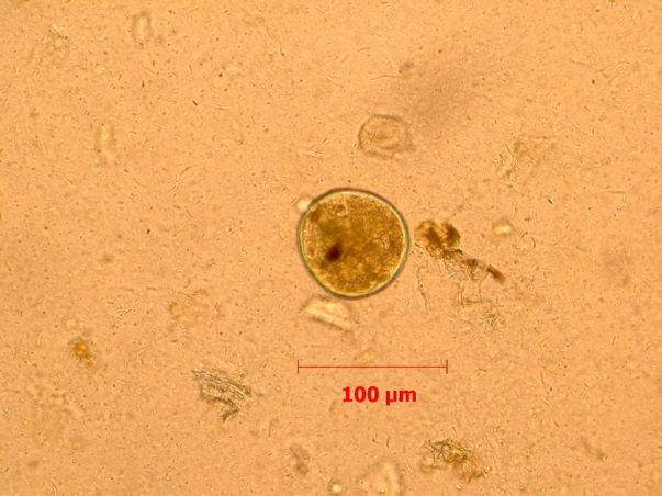 Рисунок 1. Цисты Buxtonella sulcata увеличение х400